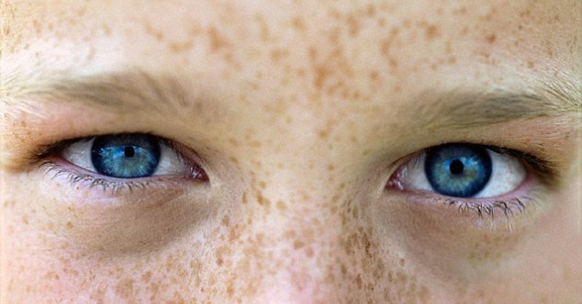 Долго смотрим глаза друг другу. Глаза в разные стороны болезнь. Boy with Freckles.