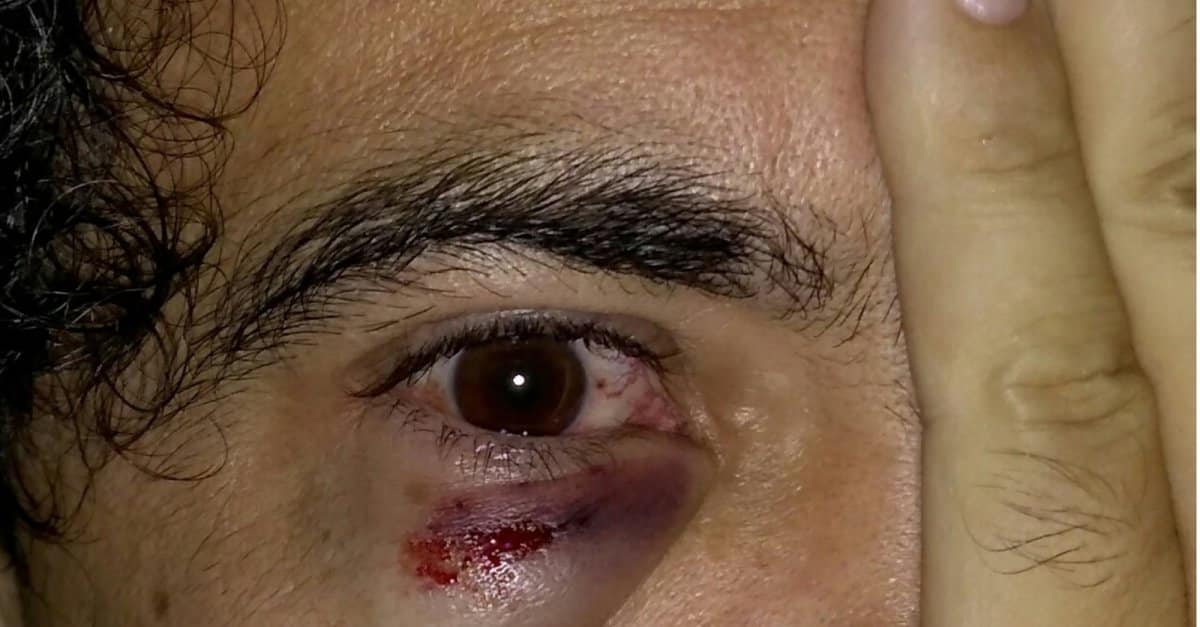 olho-ferido