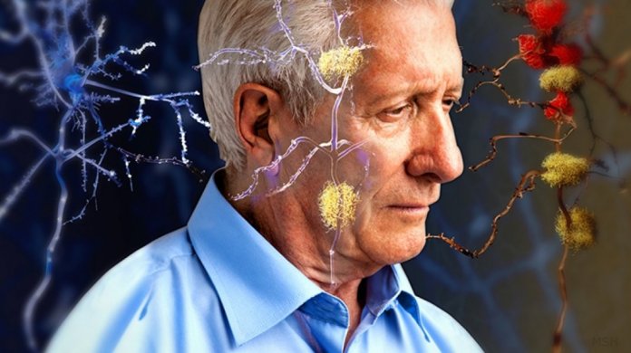 Japão descobre coquetel para combater Alzheimer: 3 remédios