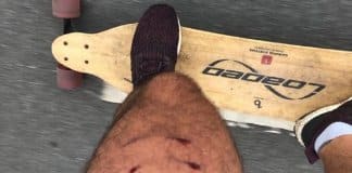 “À moça cujo cão me mordeu: me desculpe” – conheça o texto que viralizou na internet