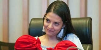 Médicos que separaram siamesas unidas pela cabeça recebem bonita homenagem