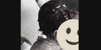 Bebê nasce com DIU preso ao cabelo, a foto viraliza e médico explica o caso
