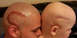 Pai que fez tatuagem de cicatriz em apoio ao filho se despede do garotinho