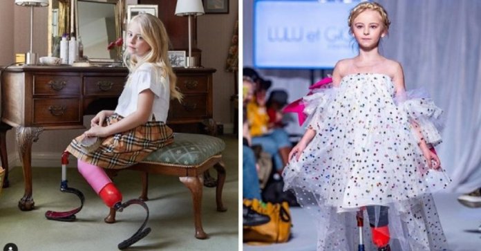 Menina com próteses duplas estreia na passarela da NY Fashion Week