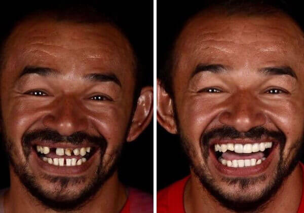 revistapazes.com - Dentista brasileiro restaura sorrisos de graça no país e no exterior