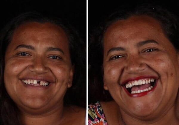 revistapazes.com - Dentista brasileiro restaura sorrisos de graça no país e no exterior