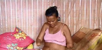 Mulher sem mãos e pernas diz que teve benefício negado pelo INSS por não poder assinar papel
