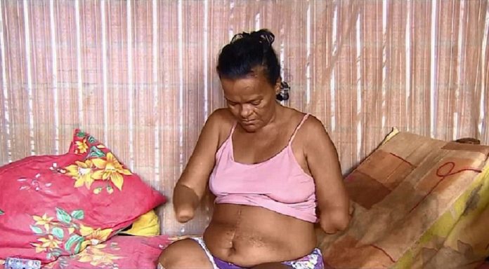 Mulher sem mãos e pernas diz que teve benefício negado pelo INSS por não poder assinar papel