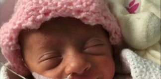 Conheça o  sorriso esperançoso do bebê prematuro que derrotou o coronavírus