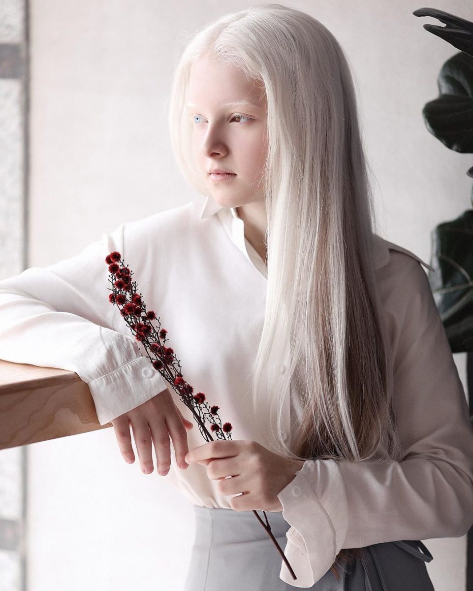 revistapazes.com - Com albinismo e heterocromia, conheça a rara e inesquecível beleza de Amina Ependevia