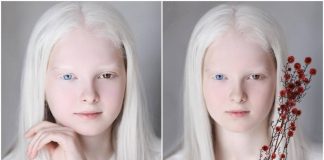 Com albinismo e heterocromia, conheça a rara e inesquecível beleza de Amina Ependevia