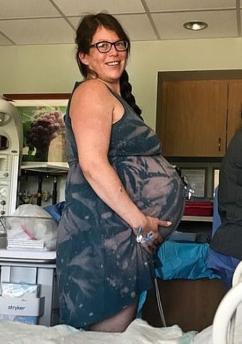 revistapazes.com - Mãe descobre que terá gêmeos segundos após nascer o primeiro bebê