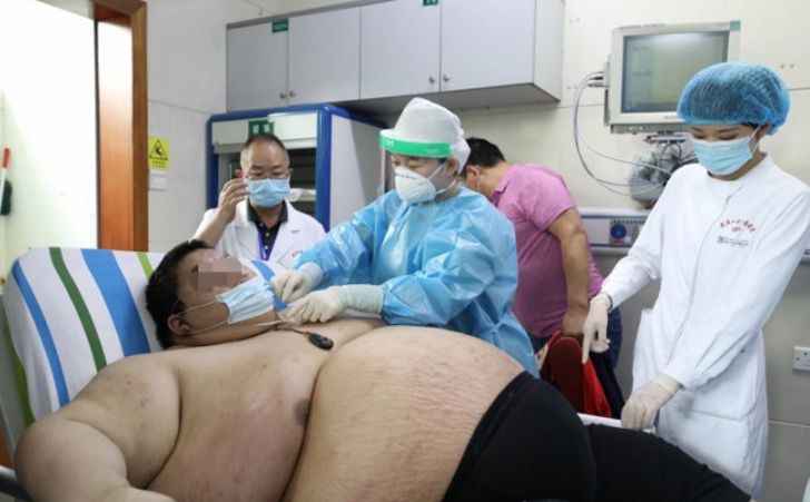 revistapazes.com - Alerta: médico chinês divulga foto de jovem que engordou 100 quilos durante a quarentena na China
