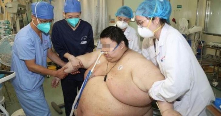 revistapazes.com - Alerta: médico chinês divulga foto de jovem que engordou 100 quilos durante a quarentena na China