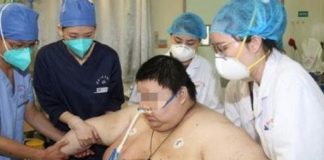 Alerta: médico chinês divulga foto de jovem que engordou 100 quilos durante a quarentena na China