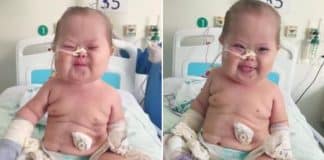 Mãe do “Super Chico”, bebê com síndrome de Down  amado na web, comemora:‘Chico venceu a Covid!’