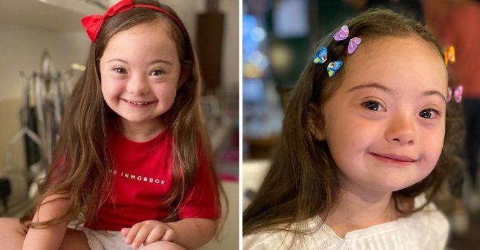 Menina de 4 anos com síndrome de Down fotografa para Gucci. Ser diferente é de onde vem a sua beleza