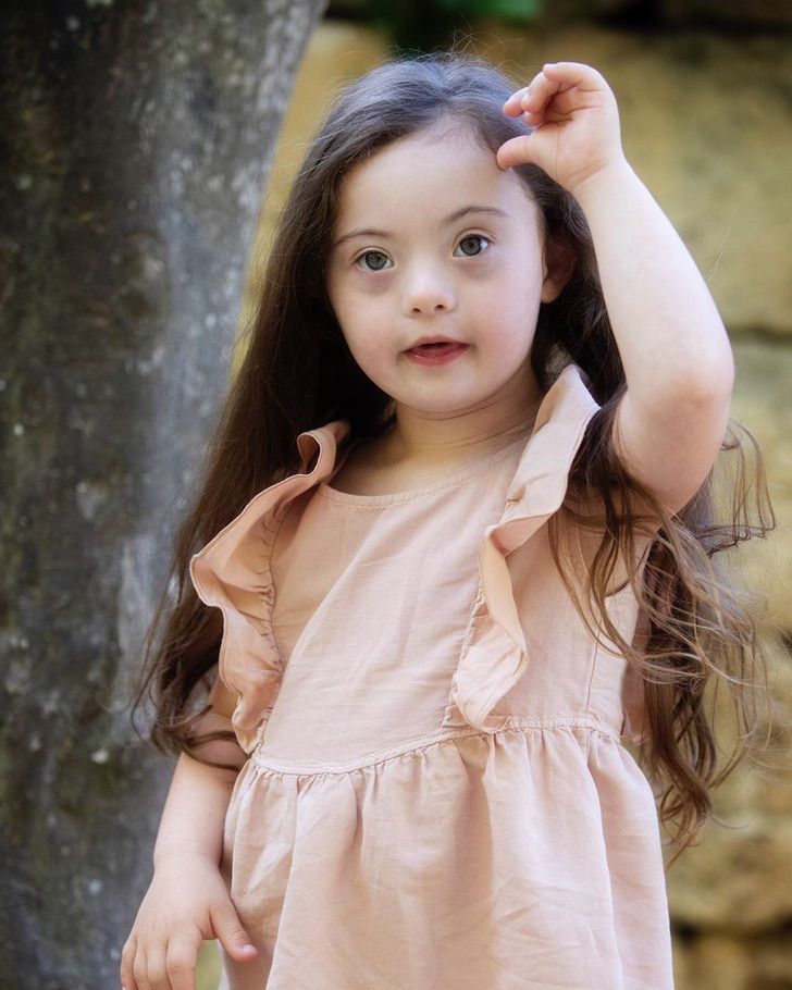 revistapazes.com - Menina de 4 anos com síndrome de Down fotografa para Gucci. Ser diferente é de onde vem a sua beleza