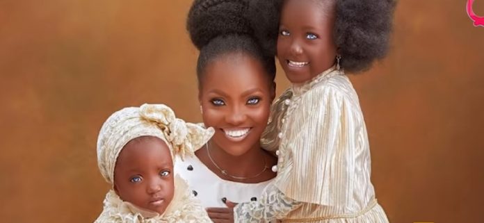 Mãe e filhas africanas sofrem estigma social por  “estranhos olhos azuis”