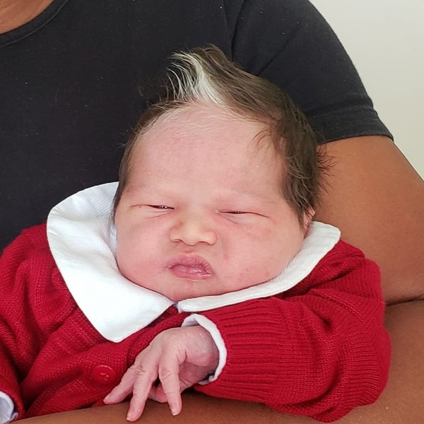 revistapazes.com - Bebê nasce com mecha de cabelo branco, em Belo Horizonte, e ganha holofote nas redes  sociais