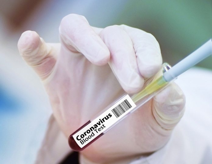 Empresa farmacêutica revela os sintomas que causaram pausa no teste da vacina de Oxford
