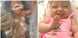 Bebê que nasceu com 800g visita equipe que a salvou