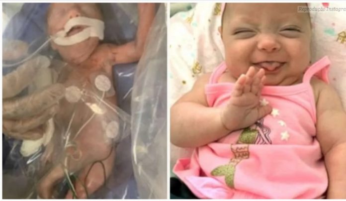 Bebê que nasceu com 800g visita equipe que a salvou