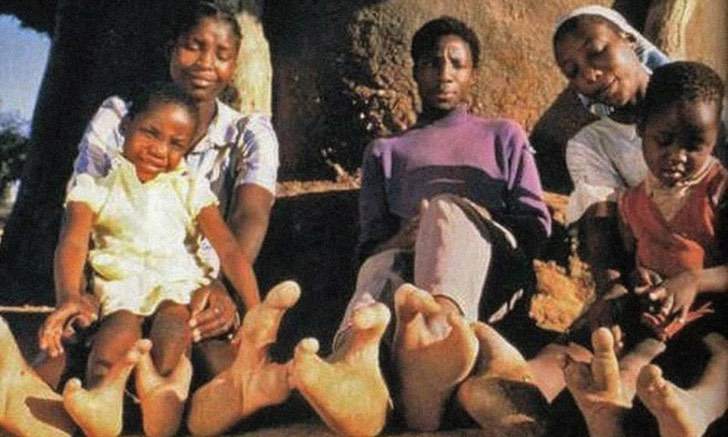revistapazes.com - Os pés dos membros da tribo africana "Vadoma" são como garras de avestruz. Eles só têm dois dedos