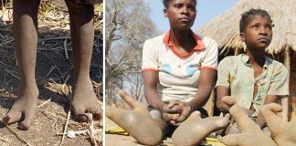 Os pés dos membros da tribo africana “Vadoma” são como garras de avestruz. Eles só têm dois dedos
