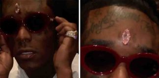 Rapper que implanta diamante na testa afirma que “pode morrer” se não removê-lo