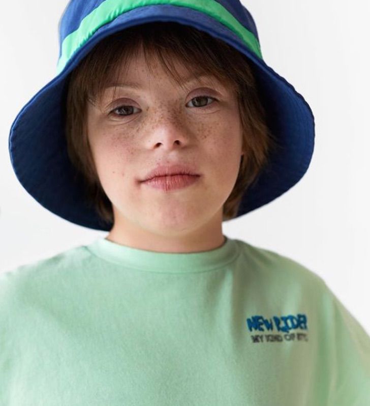 revistapazes.com - Róscon, o primeiro menino com síndrome de Down a se tornar modelo da Zara