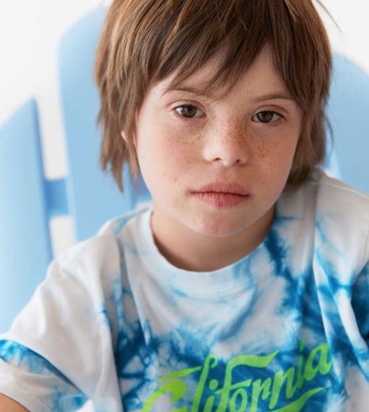 revistapazes.com - Róscon, o primeiro menino com síndrome de Down a se tornar modelo da Zara