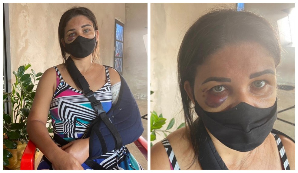 revistapazes.com - Cliente descontrolado quebra braço de funcionária de padaria após pedido para que usasse máscara