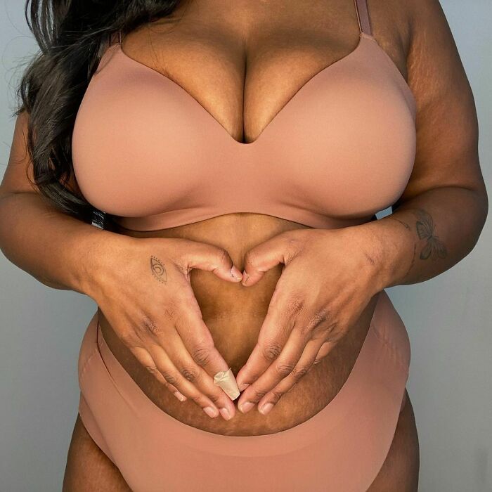 revistapazes.com - Mulheres compartilham fotos 'cruas', sem edição, para normalizar corpos reais