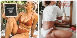 Mulheres compartilham fotos ‘cruas’, sem edição, para normalizar corpos reais