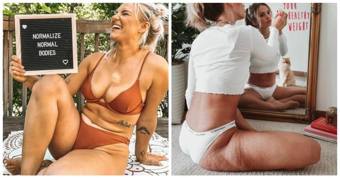 Mulheres compartilham fotos ‘cruas’, sem edição, para normalizar corpos reais