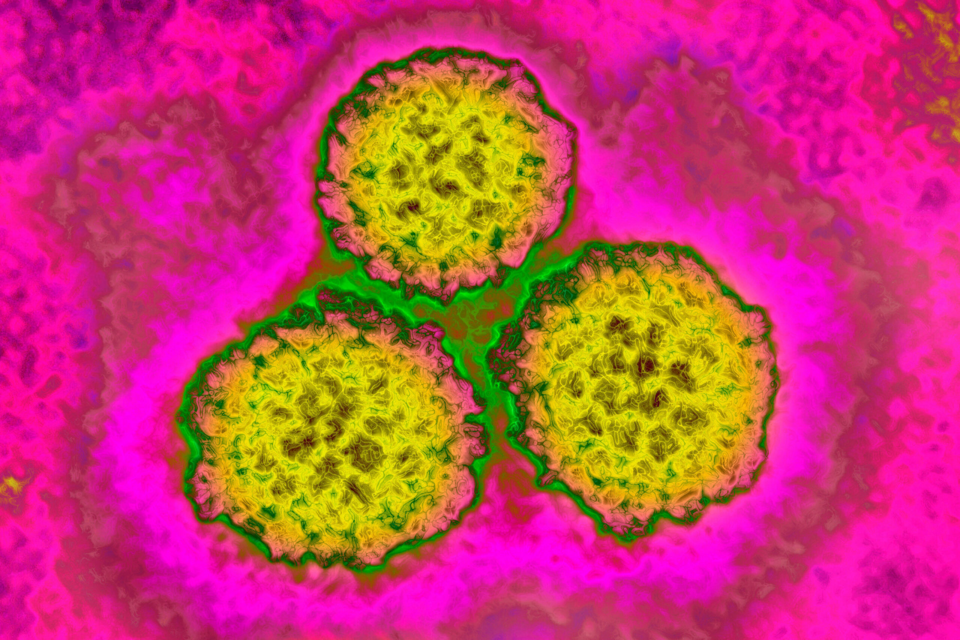 revistapazes.com - Vacina contra HPV reduz taxas de câncer no útero em até 87% em mulheres
