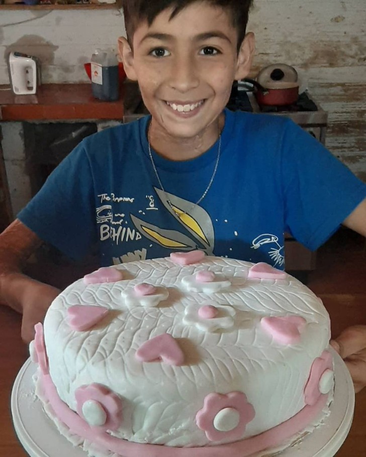 revistapazes.com - Menino de 10 anos assa bolos para pagar cirurgia reconstrutiva no rosto e pescoço