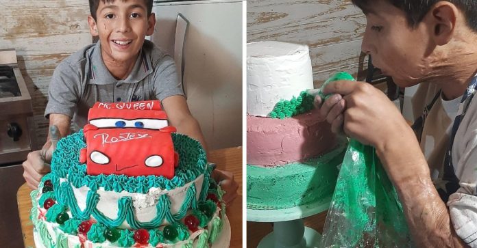 Menino de 10 anos assa bolos para pagar cirurgia reconstrutiva no rosto e pescoço