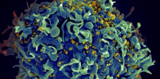 Mulher argentina elimina naturalmente HIV do seu organismo; médicos encontram anticorpos