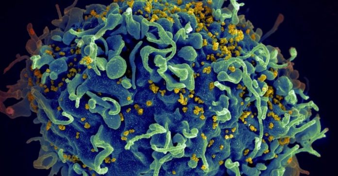 Mulher argentina elimina naturalmente HIV do seu organismo; médicos encontram anticorpos