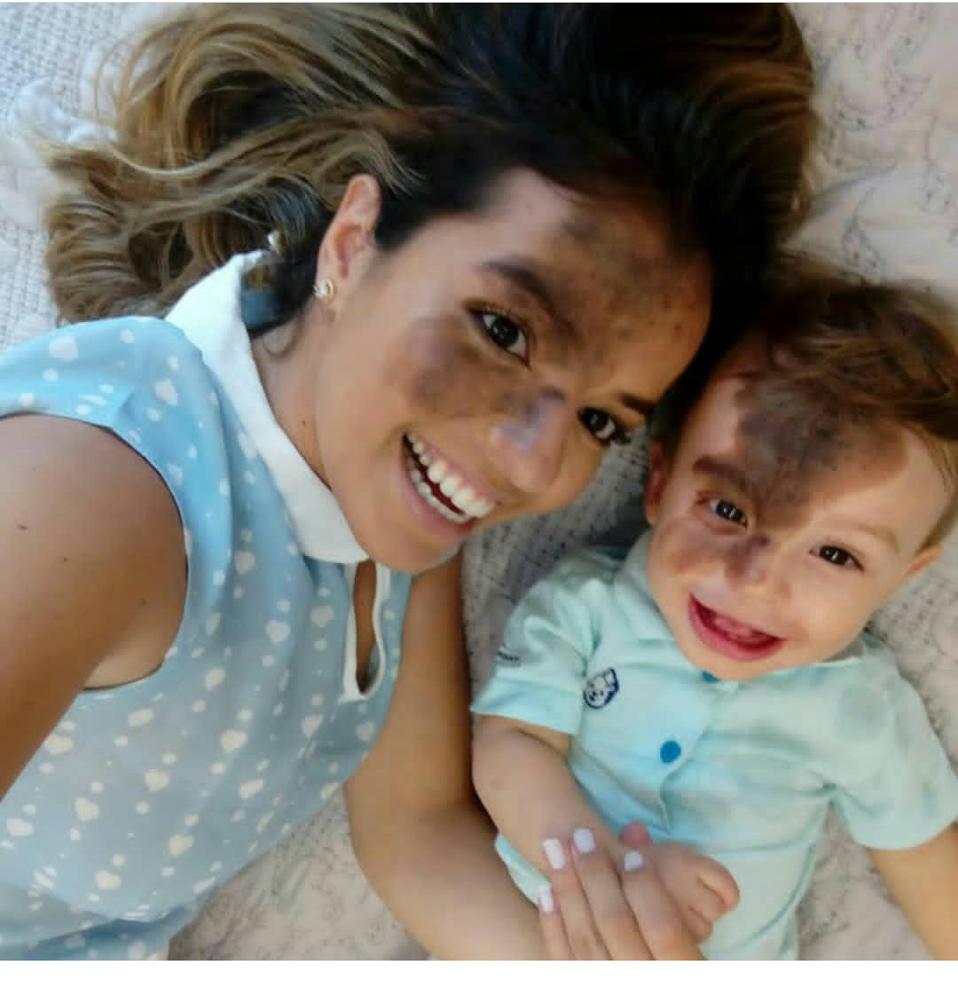 revistapazes.com - Mãe pinta marca de nascença idêntica a do filho no rosto para ensiná-lo sobre amor próprio