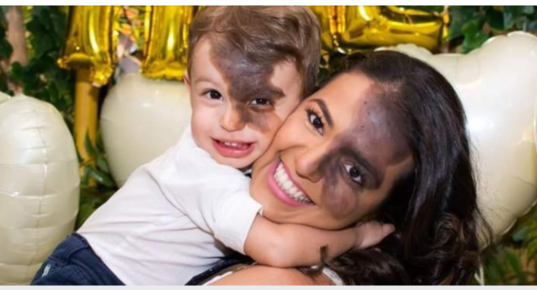 revistapazes.com - Mãe pinta marca de nascença idêntica a do filho no rosto para ensiná-lo sobre amor próprio