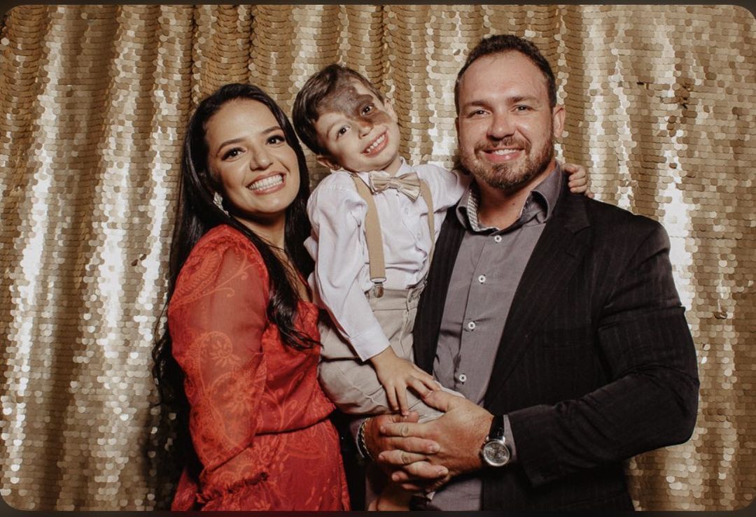 revistapazes.com - Mãe pinta marca de nascença idêntica a do filho no rosto para ensiná-lo sobre amor próprio