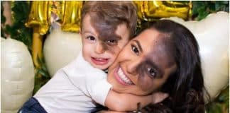 Mãe pinta marca de nascença idêntica a do filho no rosto para ensiná-lo sobre amor próprio