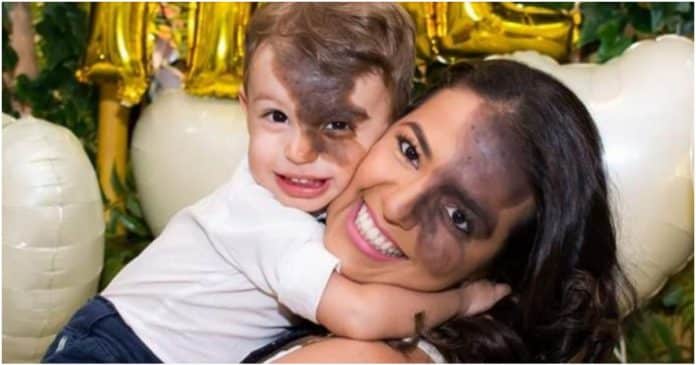Mãe pinta marca de nascença idêntica a do filho no rosto para ensiná-lo sobre amor próprio