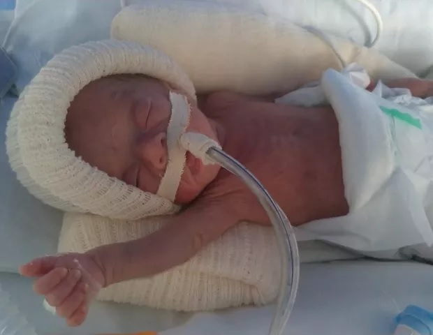 revistapazes.com - "Minha bebê nasceu prematura com 465 gramas. Diziam que ela não viveria, mas lutei por ela", desabafa mãe