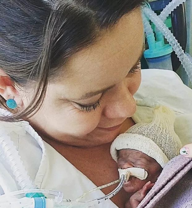 revistapazes.com - "Minha bebê nasceu prematura com 465 gramas. Diziam que ela não viveria, mas lutei por ela", desabafa mãe
