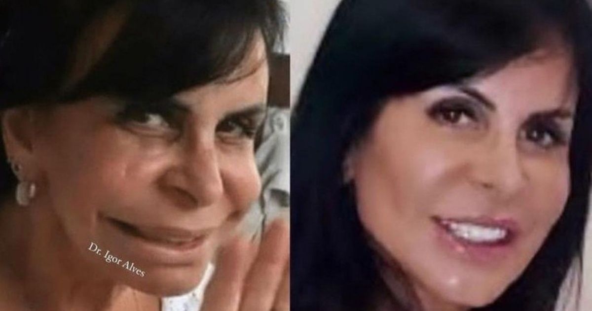 revistapazes.com - Gretchen mostra mudança no rosto após 4 anos de harmonização: 'Mudou minha autoestima'