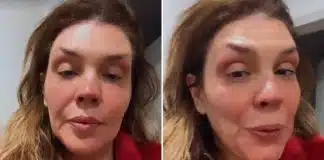 Simony começa sessões de quimioterapia e agradece carinho dos fãs: ‘Não sabia que era tão amada’